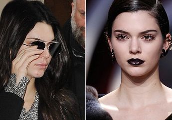 Cara Menghilangkan Jerawat Dalam Semalam ala Kendal Jenner