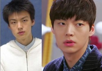 Enggak Hanya Cewek! 5 Seleb Cowok Korea Ini Juga Jadi Lebih Cakep & Sukses Setelah Operasi Plastik