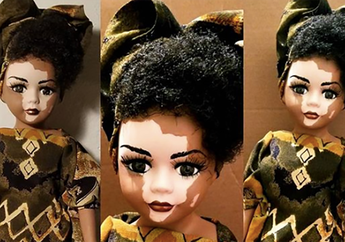Boneka Vitiligo, Model Boneka Terbaru yang Memiliki Warna Kulit Unik!