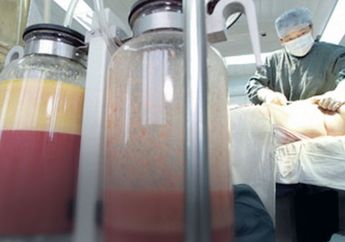 Lakukan Operasi Sedot Lemak, Seorang Wanita Meninggal di Klinik Kecantikan