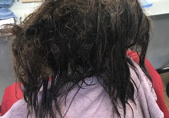Dulunya Buruk Rupa, Sekarang Gadis Ini Malah Bikin Pangling
