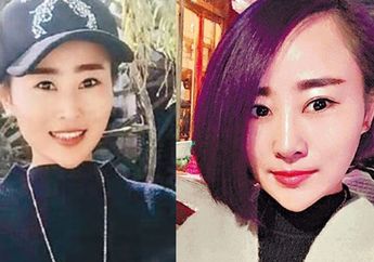 Miris! Wanita Ini Disiksa 12 Pria Hingga Wajahnya Cacat Pemanen, Pacarnya Malah Tega Meninggalkannya!