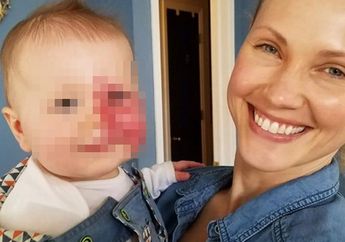 Wanita Ini Dapat Dukungan dari Ribuan Netizen Setelah Perlihatkan Wajah Anaknya di Facebook!