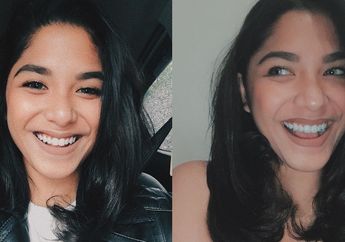 Cantik dan Eksotis, Begini Penampilan Nadine Emmanuella Anak Ruth Sahanaya yang Bikin Kamu Nggak Berkedip!