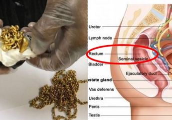 Selundupkan 1 Kg Emas di Anusnya, Pria Ini Ditangkap Petugas Bea Cukai! Waduh, Memang Nggak Sakit?
