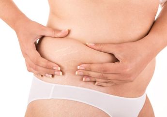 Cegah Stretch Mark Saat Hamil, Gampang kok!
