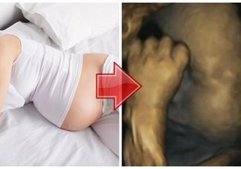 Dampak Mengejutkan Pada Janin Saat Ibunya Stres