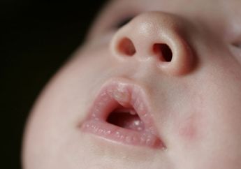 Napas Bayi Berbunyi, Normalkah?