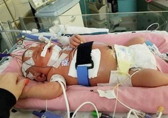 Menyayat Hati, Awalnya Bayi Ini Sehat, Tapi Kemudian Meninggal Usai Dicium Seseorang, Dokter Sempat Bingung, Ternyata Ini Penyebabnya