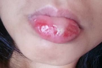 Gegara Lip Tint Bibir Gadis Cantik Bengkak, Ini 3 Risiko Terlalu Sering Menggunakannya