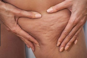 5 Bahan Alami Ini Terbukti Ampuh Hilangkan Selulit Setelah Melahirkan