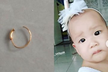 Biasa Rewel, Sang Anak Tiba-Tiba Diam Ternyata Ada Anting Di Tubuhnya