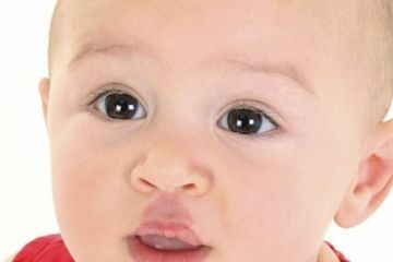 Tanda lahir pada bayi, jenis, nama, dan aneka bentuknya.