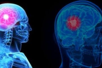 Penanganan tumor otak melalui alis