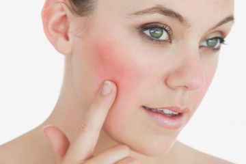 Tipe Tipe Kulit Sensitif By Dr Monita Youtube