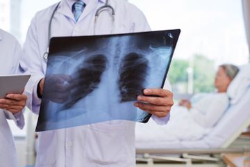 Diplococcus Pneumoniae Menyebabkan Penyakit - Mengenal Pneumonia Penyakit Radang Paru Paru Yang Diderita Stan Lee Semua Halaman National Geographic