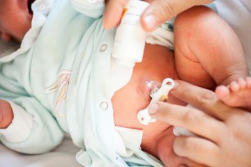 Lakukan perawatan tali pusat yang tepat pada bayi baru lahir agar terhindar infeksi.