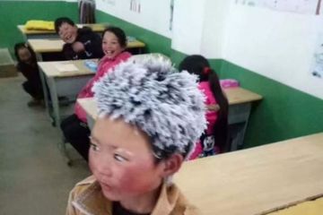 Ingat Bocah Berambut Es Asal Cina yang Sempat Viral? Ini Kabarnya ...