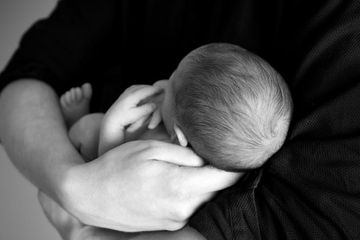 bercak putih pada pipi bayi disebabkan dari ASI?
