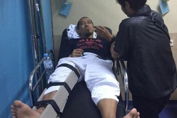 Yukie Pas Band mengalami patah tulang kaki pasca kecelakaan. Ini dia pertolongan pertamanya