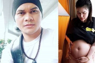 Unduh 7700 Koleksi Gambar Garis Linea Nigra Terbaik 