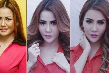 Nita Thalia Alami Bell's palsy, Kelumpuhan Wajah Pasca  Oplas 1 Miliar
