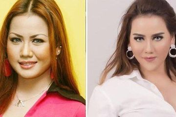 Nita Thalia alami kelumpuhan wajah setelah lakukan operasi senilai 1 miliar