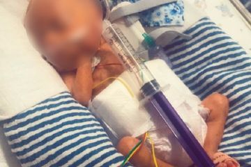 Bayi George yang ukurannya sangat kecil