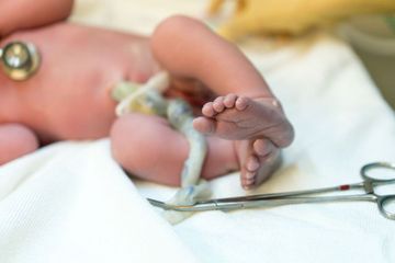 Sama halnya dengan keguguran, bayi lahir mati atau Intra Uterine Fetal Death (IUFD) dapat disebabkan oleh kondisi ibu maupun janin.