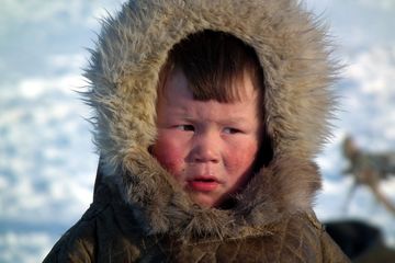 Pernah ditemukan perdarahan di kulit karena kelebihan DHA pada anak-anak dari masyarakat Eskimo