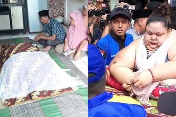 Sunarti, Gadis Obesitas Ekstrem Asal Karawang Meninggal Dunia