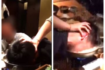 Direktur perusahaan rebus wajah karyawannya ke panci berisi air mendidih