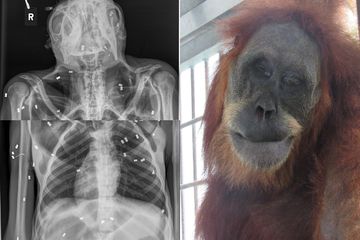 Malang Nian Seekor Orang Utan Kritis Dengan 74 Peluru Bersarang