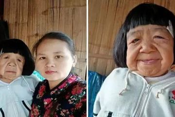 Jangan Kaget Wanita Tua Yang Anda Lihat Ini Sebenarnya Seorang Gadis Berusia 9 Tahun Semua Halaman Intisari