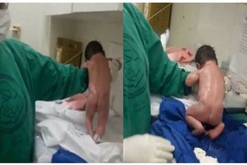 Bayi Baru Lahir Ini Bikin Perawat Terkesima! Bayi Seakan Sudah Bisa Berjalan, Fenomena Apakah Ini?