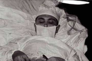 Leonid Rogozov saat melakukan pembedahan sendiri