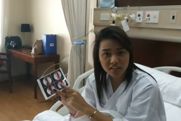 Aurel tunjukkan hasil pemeriksaan endoskopinya