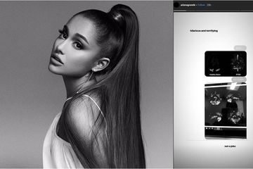 Ariana Grande unggah hasil scan otaknya