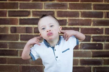Banyak masyarakat tidak mengetahui fakta sebenarnya penyakit down syndrome.
