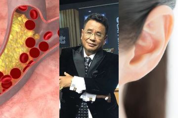 Pernah Bikin Hotman Paris Buru Buru Bagikan Warisan Ini 4 Tanda Pembuluh Darah Tersumbat Termasuk Lipatan Telinga Semua Halaman Intisari