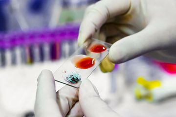 Mereka yang golongan darahnya O kebal infeksi virus corona Covid-19? 