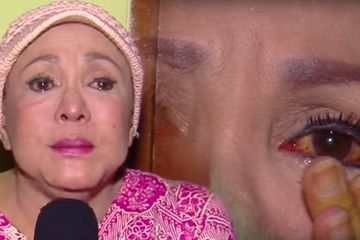 Penyesalan Mpok Atiek, karena Suntik Silikon yang Buat Wajahnya Bengkak.