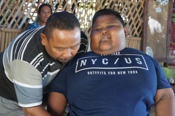 Orangtua Tolak Anaknya Dioperasi, Bocah 7 Tahun Berbobot Ratusan Kilogram Asal Karawang Akhirnya Meninggal Dunia