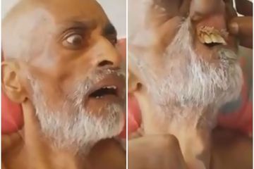 Astaga Ada Belatung Hidup Menggeliat Di Dalam Mulut Pria Ini Semua Halaman Nova