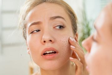 Cara Mengatasi Kulit Kering Bersisik Dengan Air Mawar Gampang Banget Semua Halaman Stylo