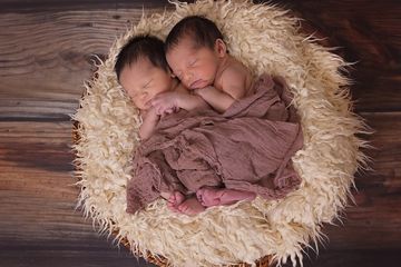 Bayi kembar identik Monochorionic Twins