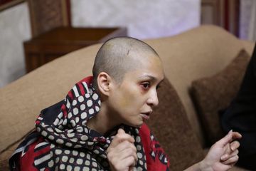 Asma Aziz, dipukuli suami gara-gara menolak perintahnya menari di depan teman-temannya.