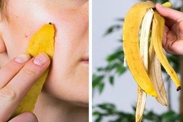 Sering dibuang, ternyata kulit pisang bisa mengatasi jerawat dan melembabkan kulit kering.