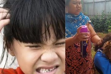 Ibu ini nekat bsami kutu rambut anaknya dengan semprotan nyamuk.