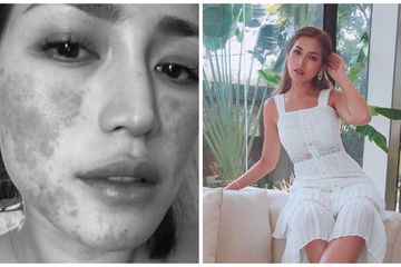 Wajah mulus Jessica Iskandar berubah jadi kemerahan setelah melakukan perawatan.